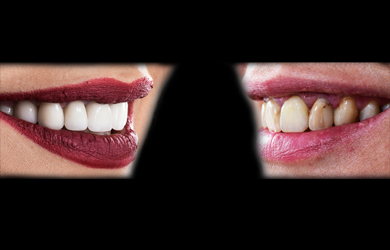 smiledesign